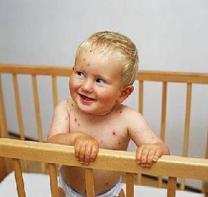 新生兒持續性肺動脈高壓