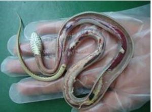 曼氏裂頭蚴 曼氏裂頭蚴