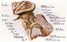小腦皮質退化症