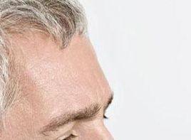 額頭皺紋突然增加 額頭皺紋突然增加