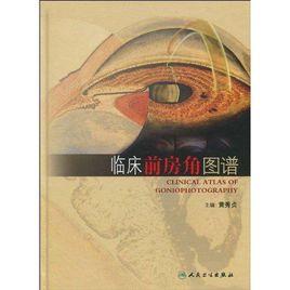 臨床前房角圖譜 臨床前房角圖譜