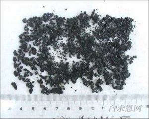 膽色素結石 膽色素結石