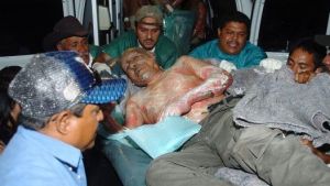 2&middot;15宏都拉斯火災中的傷者