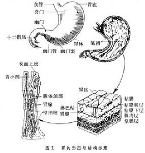 十二指腸球部潰瘍