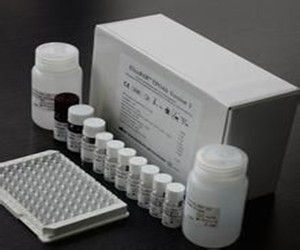 甲狀腺過氧化物酶 甲狀腺過氧化物酶