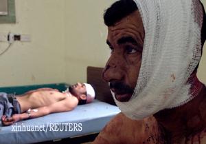 （圖）兩名自殺式汽車炸彈襲擊的傷者在醫院接受治療