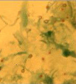 破傷風梭菌 破傷風梭菌