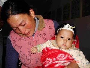 脊膜膨出與脊膜脊髓膨出