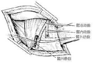 （圖）筋膜組織