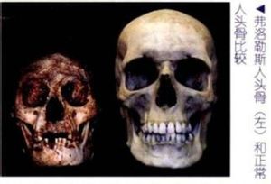 弗洛勒斯人(左)和現代人頭骨比較 