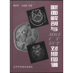 《斷面解剖與MRI CT ECT對照圖譜》 《斷面解剖與MRI CT ECT對照圖譜》