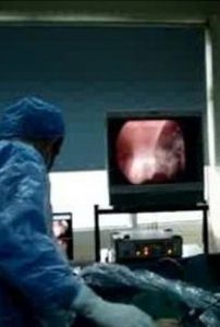 結核性滲出性胸膜炎 結核性滲出性胸膜炎