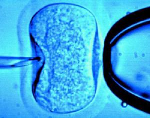 隨機的試管受精正進入少女Stanek體內