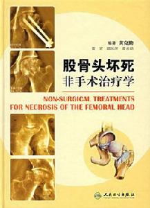 股骨頭壞死非手術治療 股骨頭壞死非手術治療
