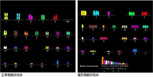 細胞DNA腫瘤早期診斷技術 細胞DNA腫瘤早期診斷技術