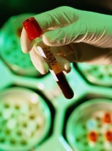 血漿游離血紅蛋白測定