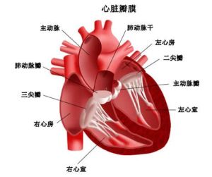 主動脈瓣閉鎖不全