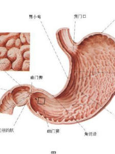 卓-艾綜合徵 卓-艾綜合徵