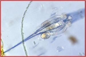 輪形動物門 輪形動物門