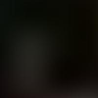 IC 1598 RASS 彩色圖