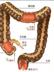 里急後重 里急後重