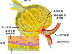 腎小球性蛋白尿
