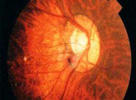 晚霞樣或夕照樣眼底 晚霞樣或夕照樣眼底