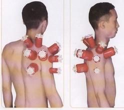 拔罐穴位 拔罐穴位