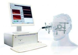 無創顱內壓監測儀 無創顱內壓監測儀