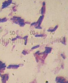 酪酸梭菌