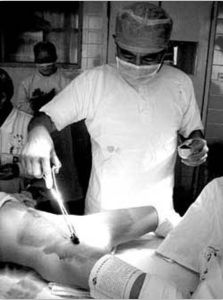 男性假兩性畸形 男性假兩性畸形