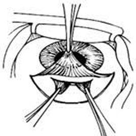 鞏膜疾病 鞏膜疾病