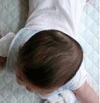 扁頭綜合症 扁頭綜合症