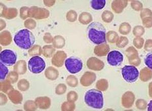 淋巴細胞活素 淋巴細胞活素