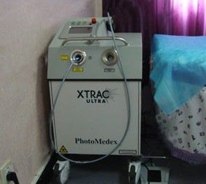 308準分子雷射白癜風治療儀 308準分子雷射白癜風治療儀