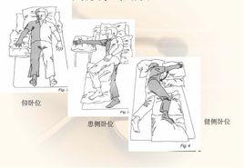 良肢位 良肢位