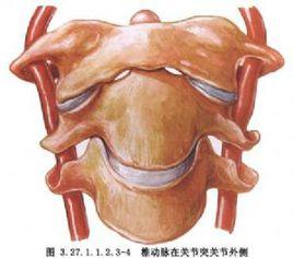 頸椎病前路減壓融合術