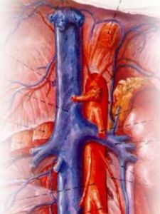 腹主動脈 腹主動脈