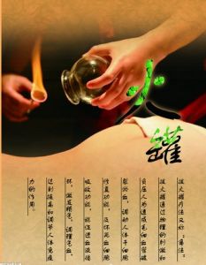 拔火罐 拔火罐