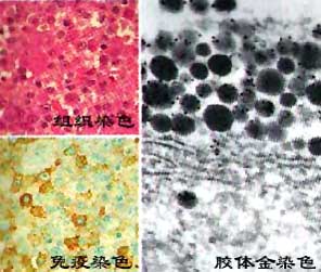 （圖）膠體金標記技術