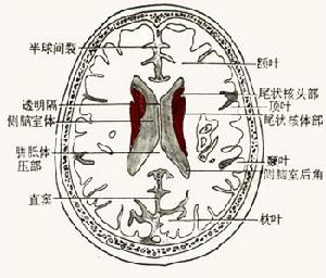 兒童結核性腦膜炎 兒童結核性腦膜炎