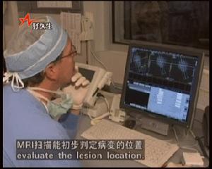 腦外傷所致精神障礙