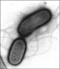 大腸革蘭染色菌（結腸性潰瘍）演變圖譜