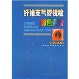 《纖維支氣管鏡檢彩色圖譜》