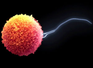 輕度弱精症 輕度弱精症