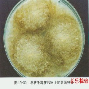 總狀毛霉 總狀毛霉