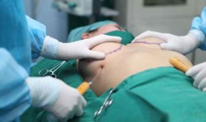 注射隆胸 注射隆胸