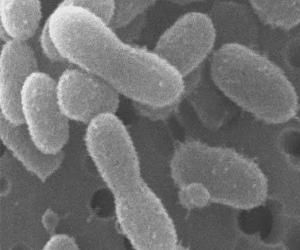 肺炎克雷伯桿菌 肺炎克雷伯桿菌