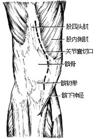 （圖）踝關節結核