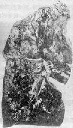 普通問質性肺炎